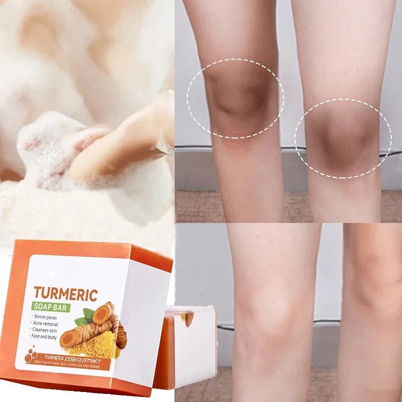 turmeric soap for legs body dark spots