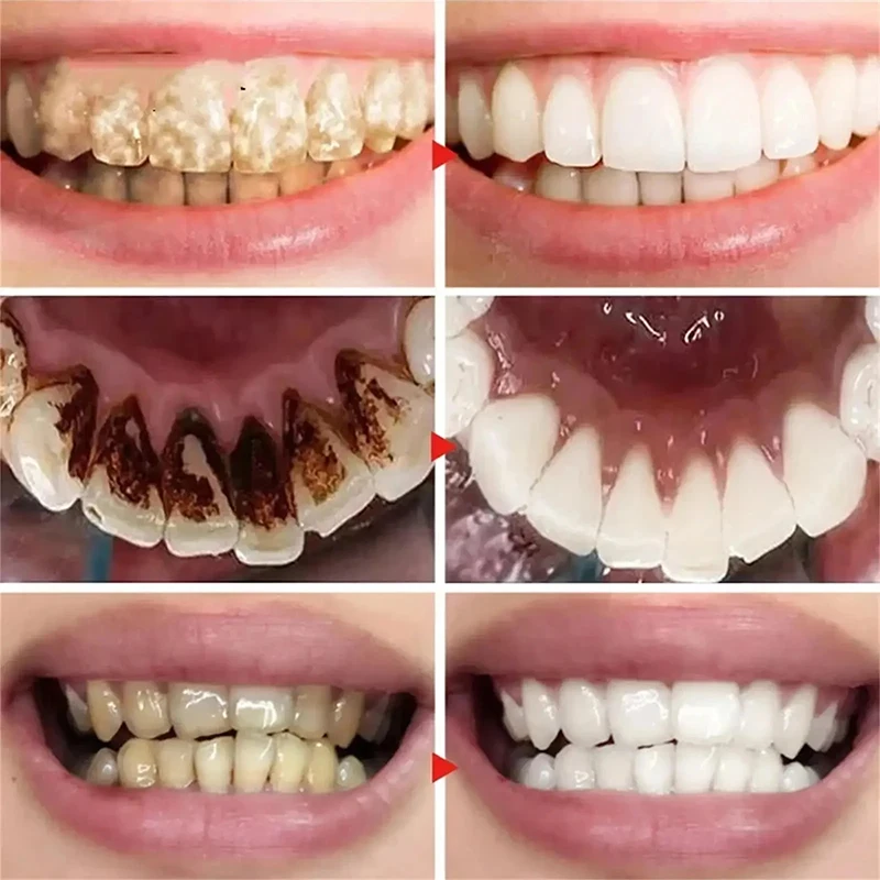 kf-S0aa6104fa5554d06af79289e5823ab62K